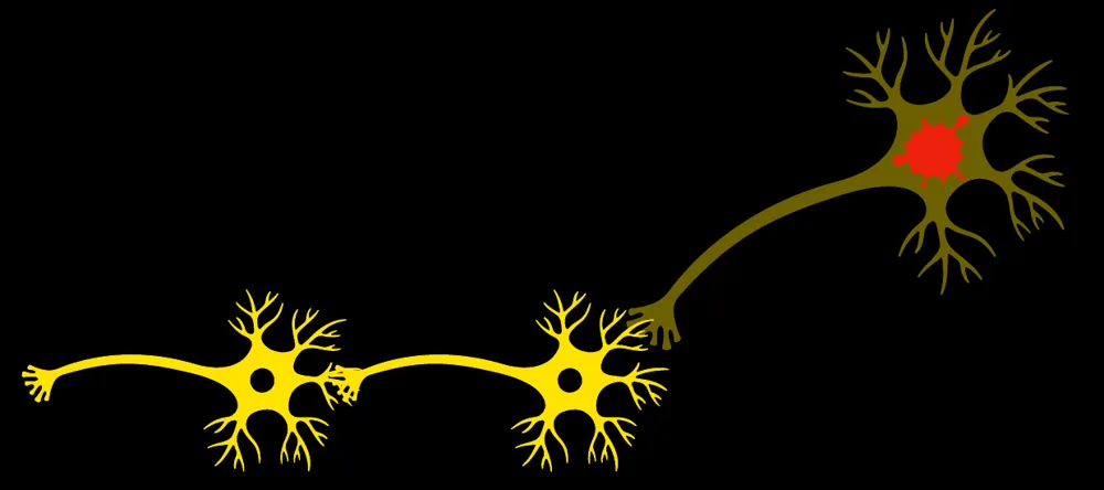 Illustration of a chain of healthy yellow neurons connected to a damaged neuron shown in dark gold with a red center.